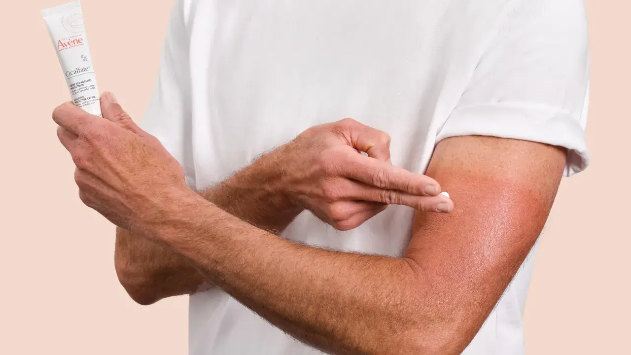 Un homme applique la crème Cicalfate+ sur son bras irrité, peut-être atteint de psoriasis, pour apaiser et réparer sa peau.