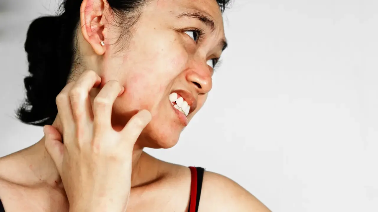 Une femme se gratte le visage et le cou, la peau rougie et irritée, signe d'une sensation de visage qui gratte et brûle.