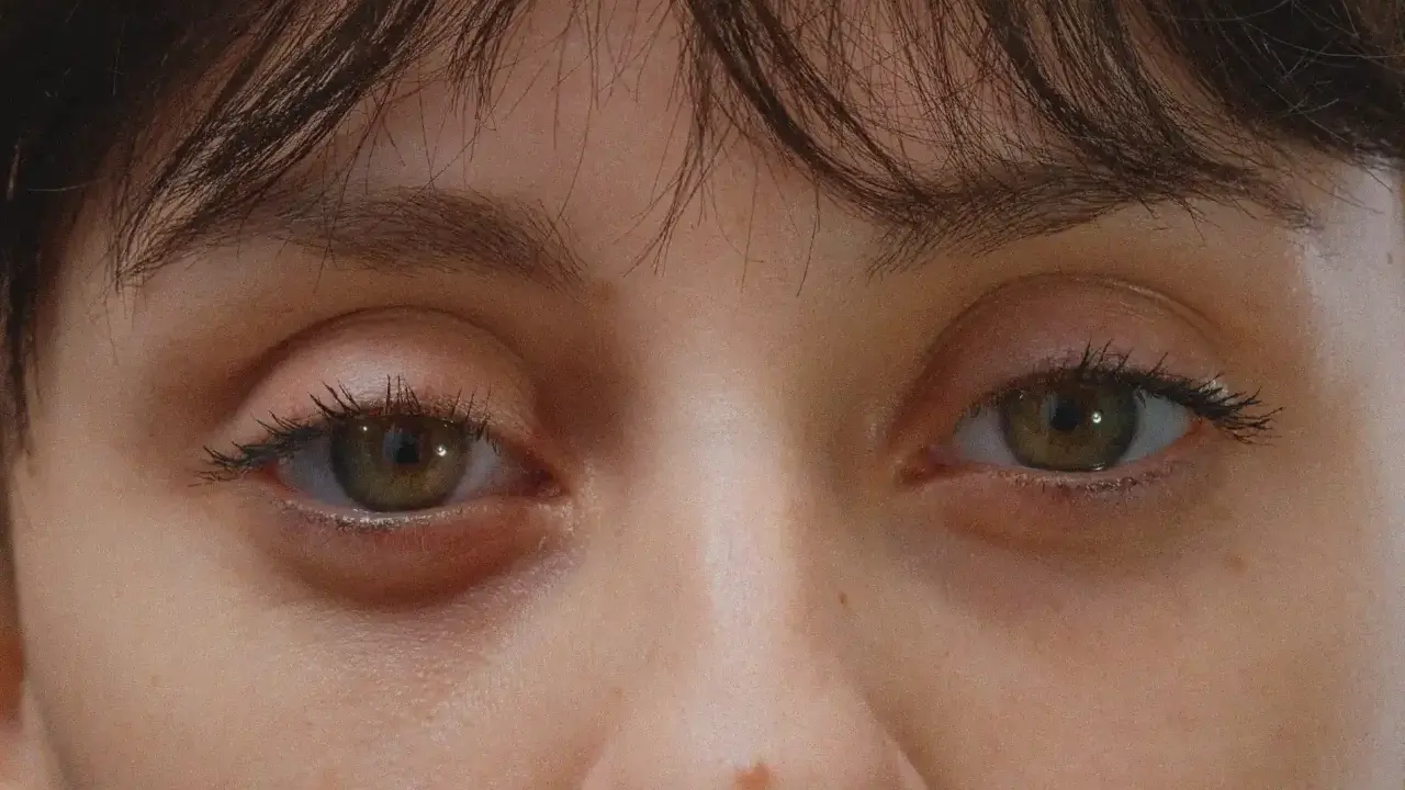 Gros plan sur des yeux verts, l'un d'eux présente une poche sous l'œil gonflée, signe d'une nuit agitée.