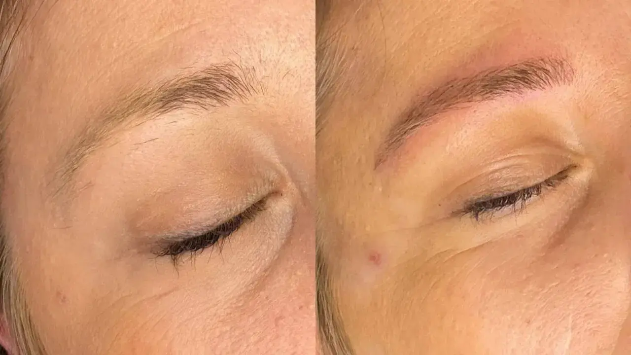 Avant/après d'un **tatouage sourcil** : les sourcils sont plus définis et remplis, offrant un regard plus intense.