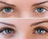 Avant/Après : des yeux bleus aux cils naturels, puis des cils longs et volumineux, posés cil à cil pour un regard de biche.