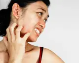 Une femme se gratte le visage et le cou, la peau rougie et irritée, signe d'une sensation de visage qui gratte et brûle.