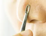 Un outil métallique est utilisé pour extraire un comédon fermé sur le nez.