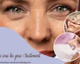 Traitement des rides sous les yeux : gros plan sur un visage, avec des images de soins esthétiques.