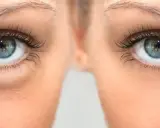 Gros plan sur des yeux bleus, montrant des poches sous les yeux. Le bicarbonate de soude est une astuce maison pour les atténuer.