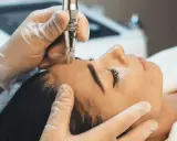 Un appareil de microneedling visage est utilisé par des mains gantées pour un soin de la peau.