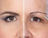 Comparaison avant/après : une jeune femme avec des sourcils bien dessinés et une femme plus âgée cherchant à remonter les sourcils naturellement.