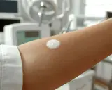 Une plaque blanche sur la peau, appliquée sur un bras dans un environnement médical.