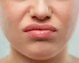 Gros plan sur une bouche pincée, le nez rouge que faire ? Une expression de dégoût ou de gêne.
