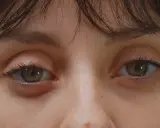 Gros plan sur des yeux verts, l'un d'eux présente une poche sous l'œil gonflée, signe d'une nuit agitée.