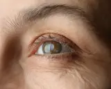 Gros plan sur un œil humain, montrant des rides autour de l'œil et une légère perte de cils.