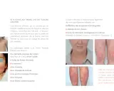 La Station thermale d'Avène traite diverses pathologies cutanées, comme l'eczéma et le psoriasis, illustrées par des photos.