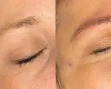 Avant/après d'un **tatouage sourcil** : les sourcils sont plus définis et remplis, offrant un regard plus intense.