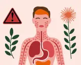 Attention : achillée millefeuille danger. Illustration d'une personne réagissant à une plante, avec des éruptions cutanées et des organes internes affectés.