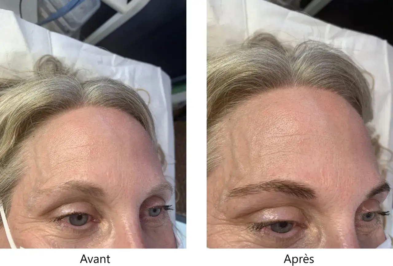 Teinture sourcils avant/après : des sourcils blonds naturels plus définis.