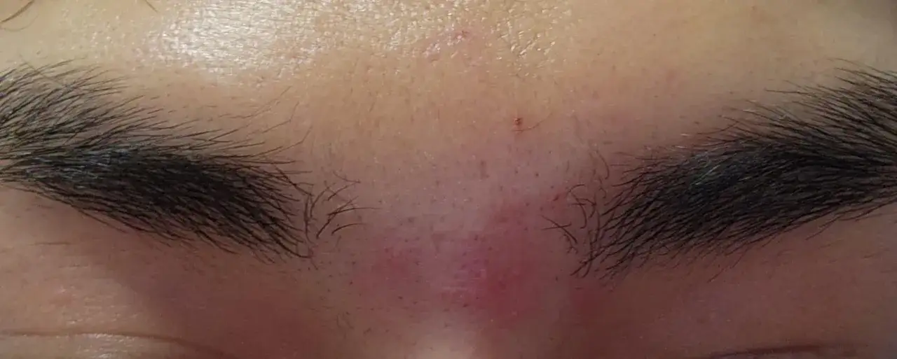 Un petit point rouge sur le front, près du sourcil, suggère un poil incarné sourcil.