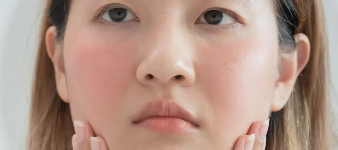 Gros plan sur le visage d'une jeune femme, ses joues légèrement rosées. Elle touche son menton avec ses doigts.