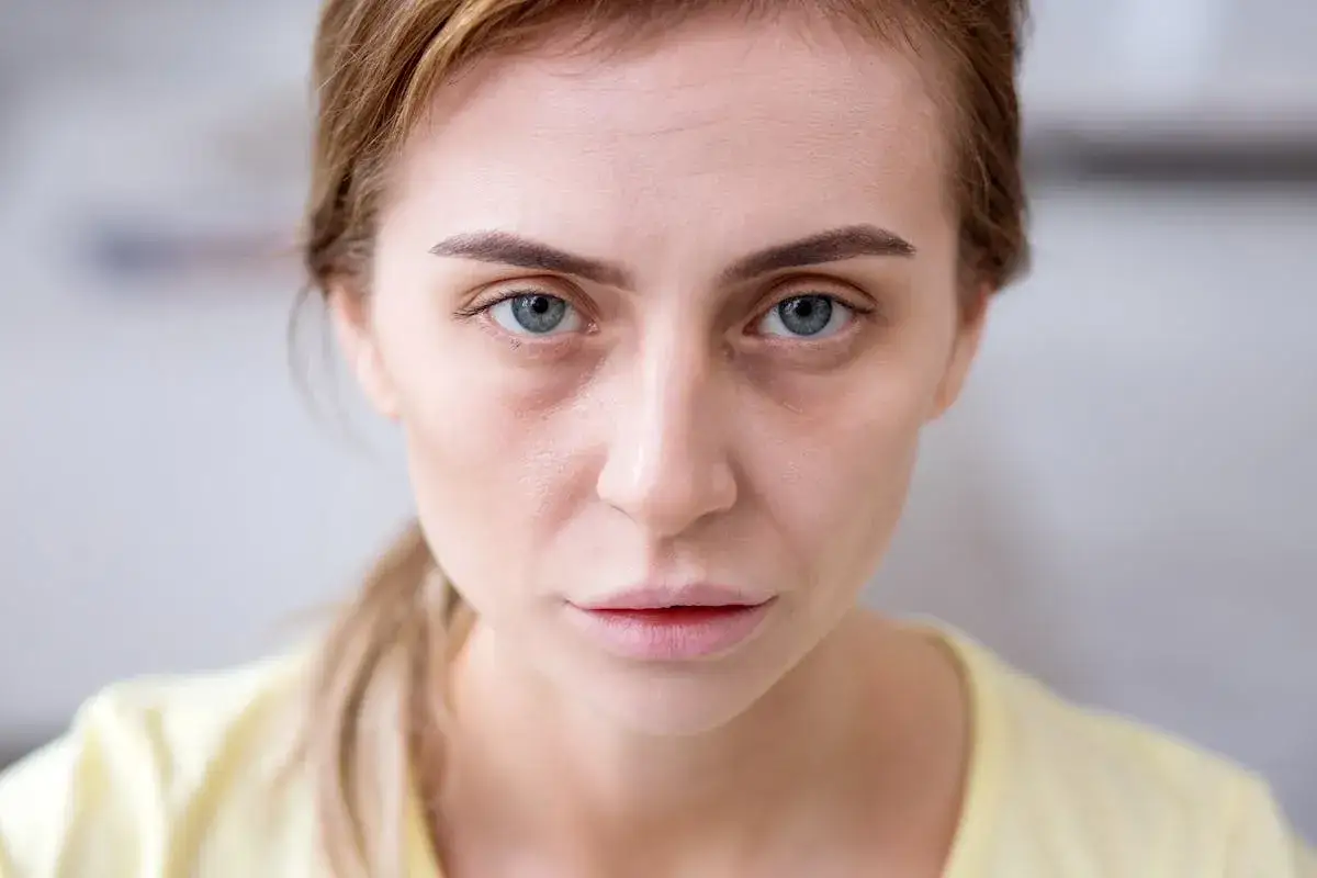 Visage d'une femme aux yeux bleus, avec des cernes creuses marquées sous les yeux, regardant fixement.