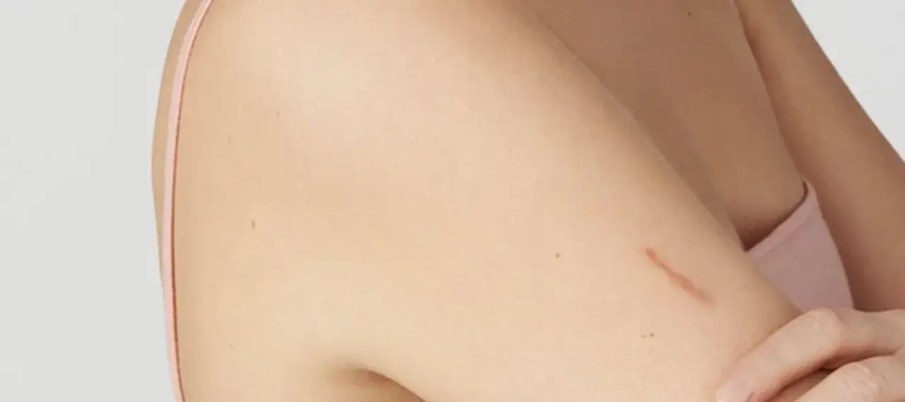 soins d'une plaie superficielle nettoyage pansement peau abîmée