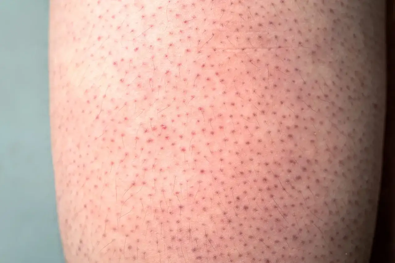 Gros plan sur une peau de fraise, avec de minuscules points rouges et des poils fins.