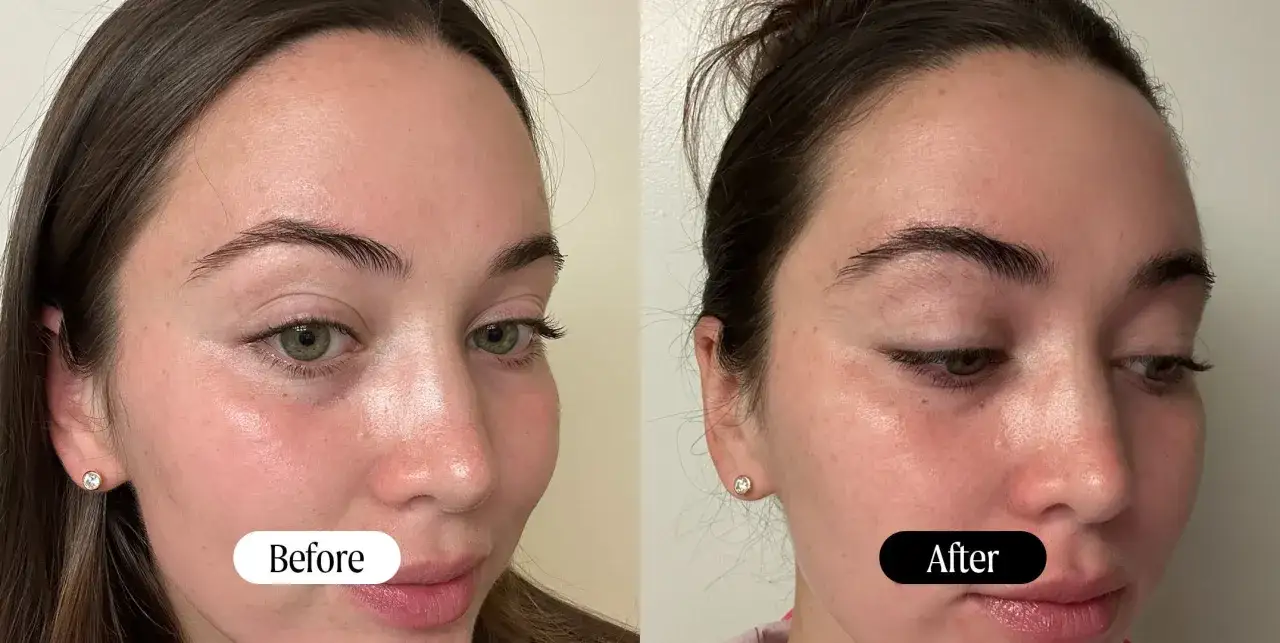 Avant/après : une femme montre ses sourcils plus fournis. Le secret pour comment faire pousser ses sourcils en 1 nuit ?