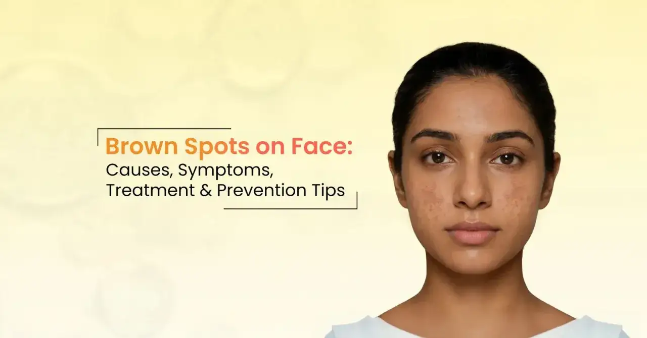 Visage d'une jeune femme présentant une tache brune sur la peau, avec un texte informatif sur les causes et traitements.