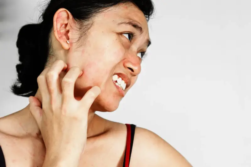 Une femme se gratte le visage et le cou, la peau rougie et irritée, signe d'une sensation de visage qui gratte et brûle.